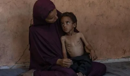 Gazze’de açlık nedeniyle hayatını kaybedenlerin sayısı artıyor